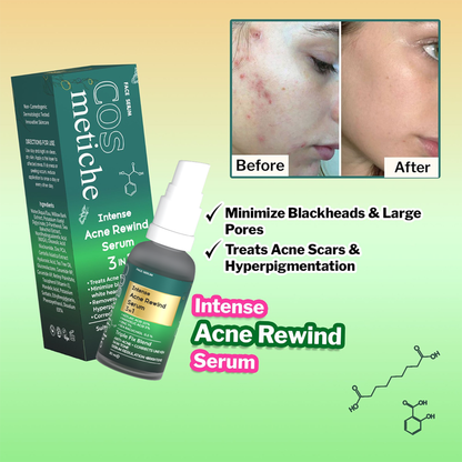 Intense Acne Rewind Serum