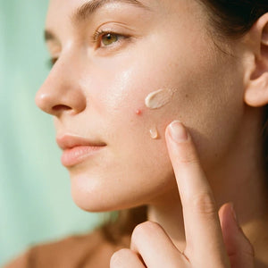 Acne & Breakouts