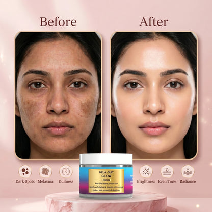 Mela-Quit Glow Cream