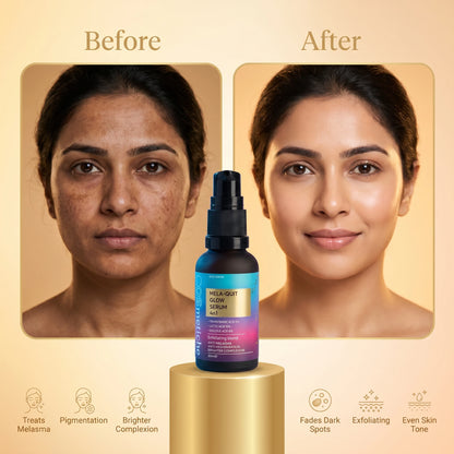 Mela Quit Glow Serum