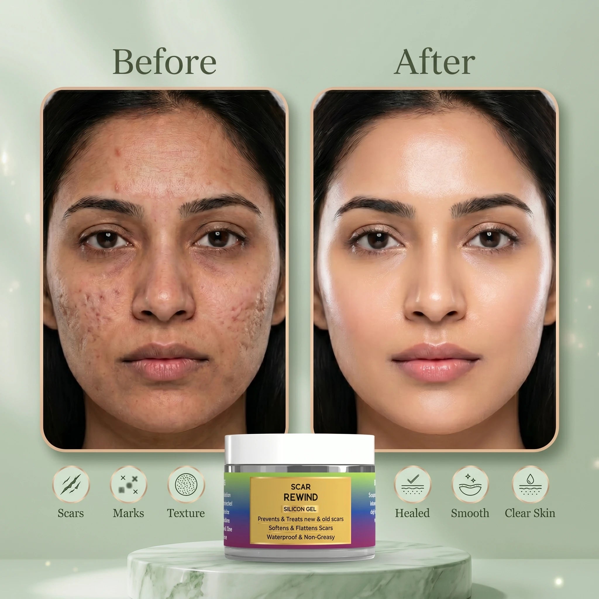 Scar Rewind Silicone Gel
